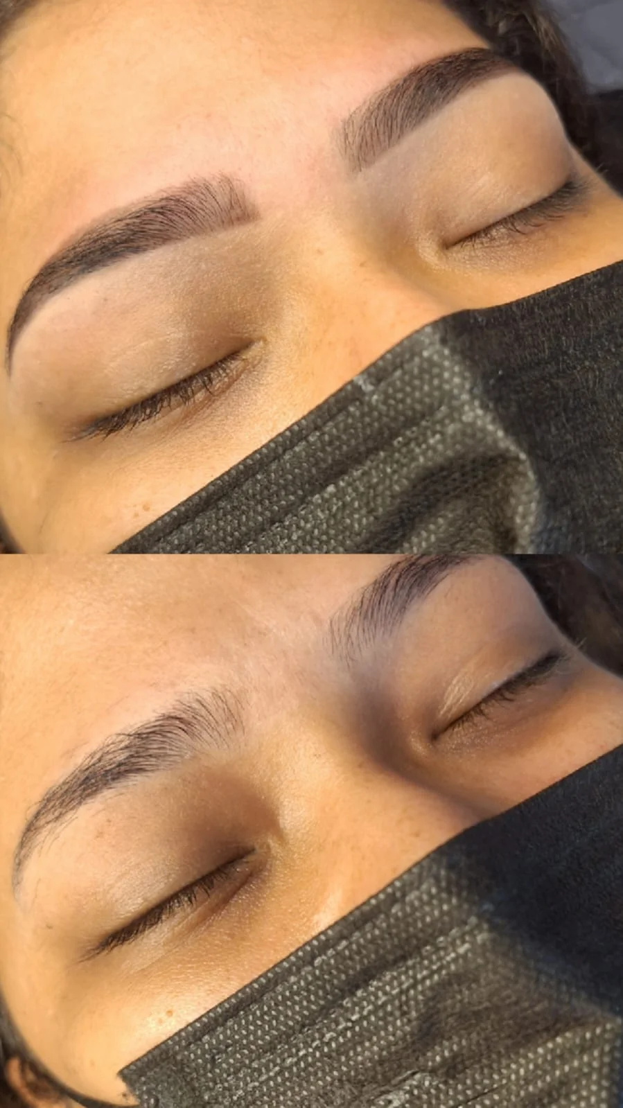 Antes e depois: lifting de sobrancelha, detalhe